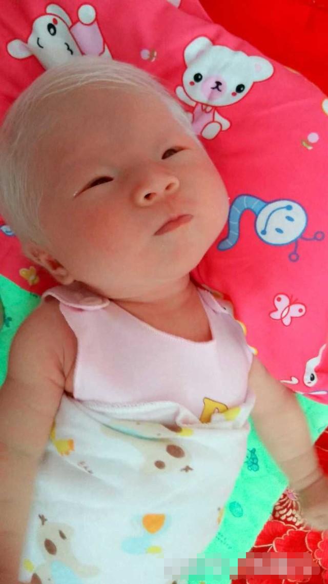 剛出生的女兒「一頭白髮」，漂亮至極！但醫生的「一番話」卻讓媽媽陷入了深深地痛苦之中！！