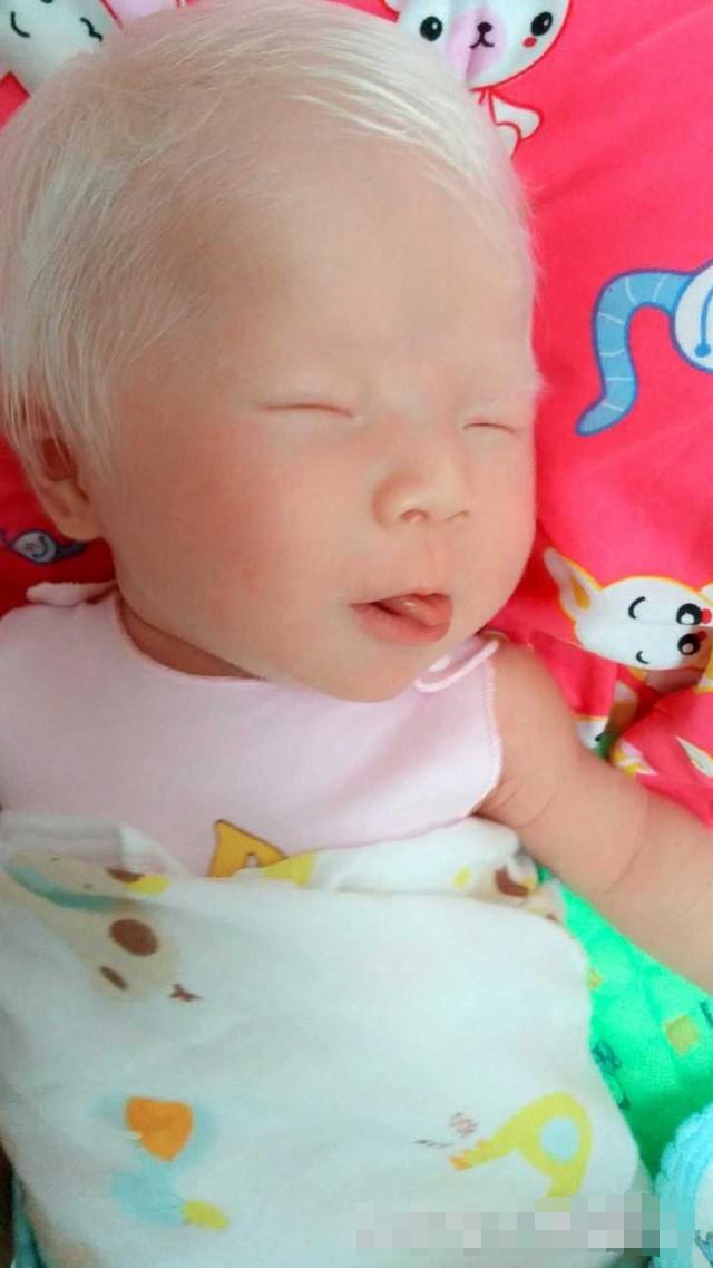 剛出生的女兒「一頭白髮」，漂亮至極！但醫生的「一番話」卻讓媽媽陷入了深深地痛苦之中！！