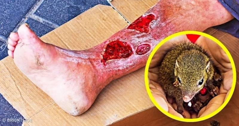 10個看起來無害的生物和物品，其實他們都有可能殺人於無形之中！一起來看看到底是什麼吧！﻿