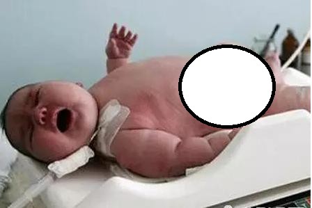 澳洲300公斤孕婦臨盆竟「出動直升機」!沒想到嬰兒出生後的模樣,連護士都嚇一大跳了!