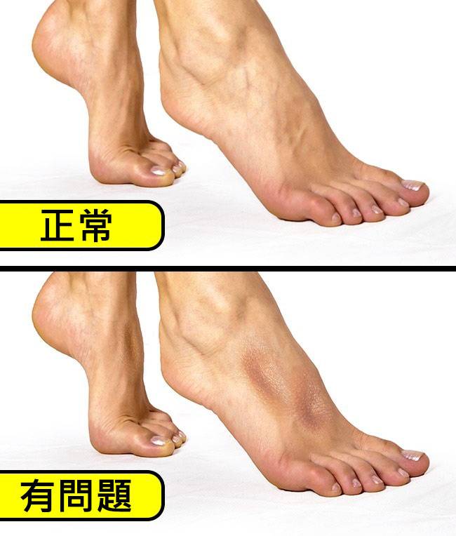 7個只要1分鐘就完成的「超簡單自我健康檢測法」！#1 大拇指3秒鐘！