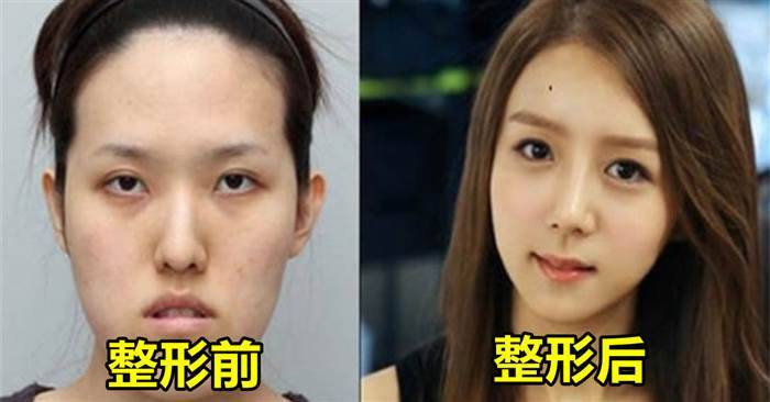 「12張令人啞口無言瞬間呆住的整形前後對照圖」韓國這整形科技簡直不科學
