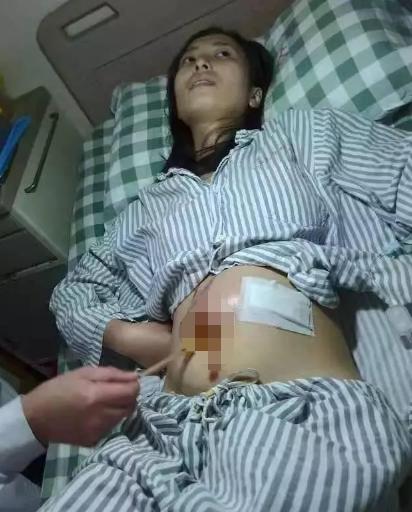 23歲女生腹大如球，一上救護車，醫生就說「不用救了」！女人都要小心…