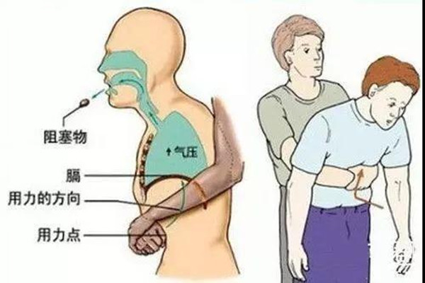 女兒莫名其妙瘦成一根柴，送檢查醫生叫把項鍊拿掉！母回：根本沒戴！醫生：糟了，快動手術