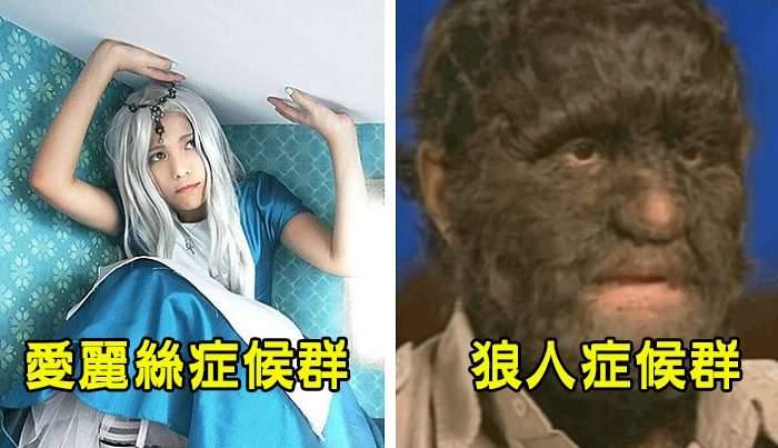 盤點10種「科學無法解釋的怪異病狀」，#9每天醒來都以為自己是殭屍…