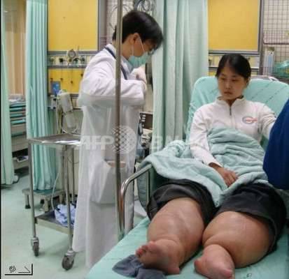 盤點10種「科學無法解釋的怪異病狀」，#9每天醒來都以為自己是殭屍…