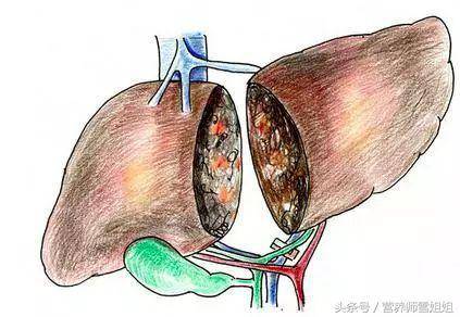 肝不好的人，多吃「3綠」，少吃「2物」，肝會一天比一天好！