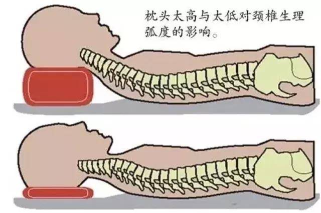 枕頭用錯了傷頸椎，你可能一直沒用對