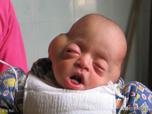 不要這樣搖晃嬰兒，每年有受害者！