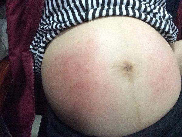 產婦生龍鳳胎，護士來報喜，家人卻都耷拉著臉，聽到解釋醫生落淚