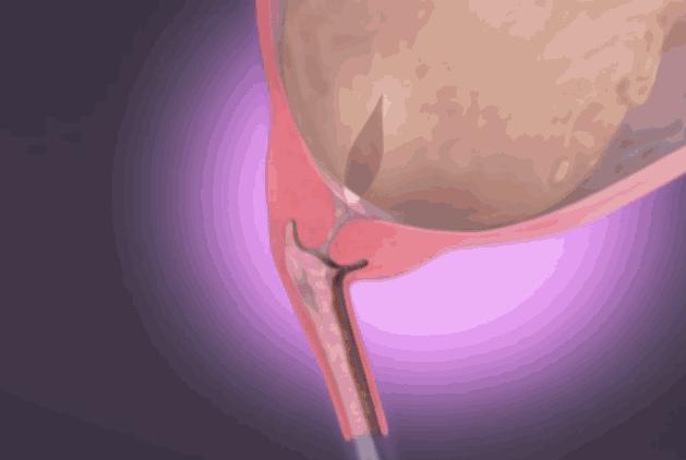 順產到底有多痛？女人到底有多不容易？老公看完18張圖，說：不生了