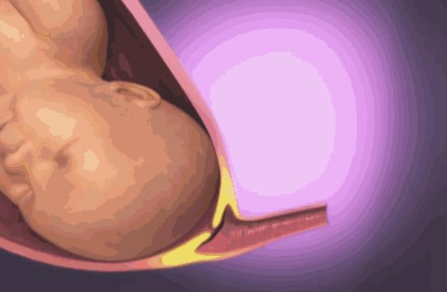 順產到底有多痛？女人到底有多不容易？老公看完18張圖，說：不生了
