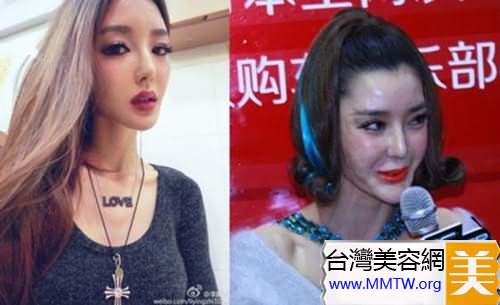  46歲鍾麗緹遭偷拍「臉上滿滿針孔」！女星為了不老「亂打針的下場」竟是....嚇到腿軟！