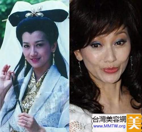  46歲鍾麗緹遭偷拍「臉上滿滿針孔」！女星為了不老「亂打針的下場」竟是....嚇到腿軟！