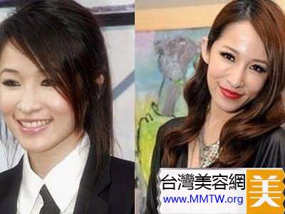  46歲鍾麗緹遭偷拍「臉上滿滿針孔」！女星為了不老「亂打針的下場」竟是....嚇到腿軟！