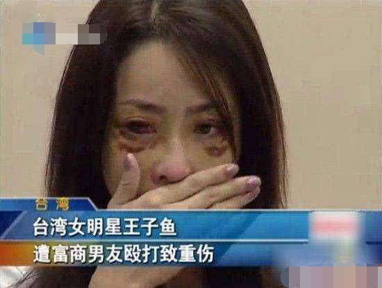 女星遭51歲富商男友家暴，打成腦震蕩頭骨骨折還吐血慘不忍睹~