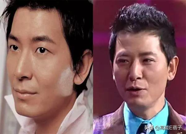 49歲陳浩民公開打針微調照片，這些男星都承認自己嘗試過醫美