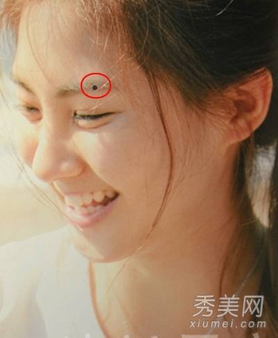 痣相看富貴財運：會給你招財的七種痣，要錢有錢，好運相伴，你有嗎？