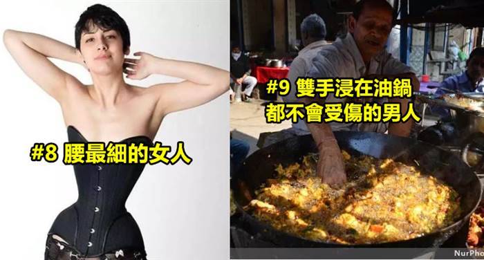 10個真實存在的超奇葩人體構造