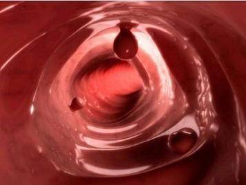 大腸病變的人越來越多，謹記：身體出現【3多2痛】，趕緊去醫院檢查，能救你一命