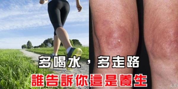 多喝水，多走路，誰告訴你這是養生，小心這些要命的養生法！