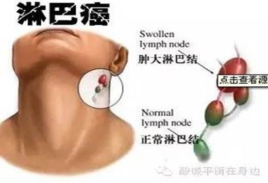 人體三處淋巴關係身體健康，老中醫分享淋巴按摩，關鍵時可能救你一命 !