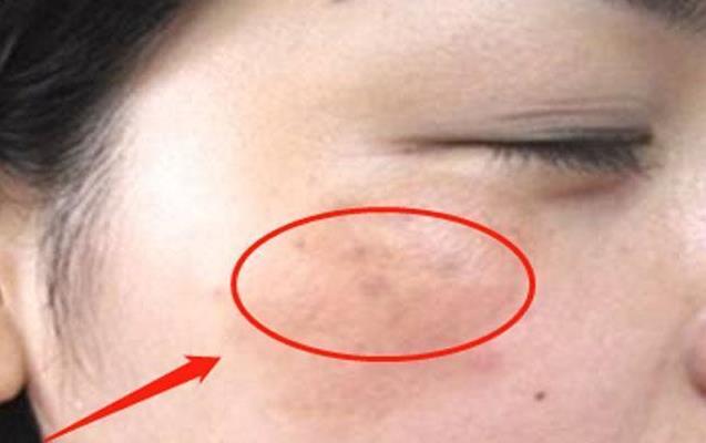 子宮健康的女性，臉上不會有4種表現，常喝1種水，子宮更光滑