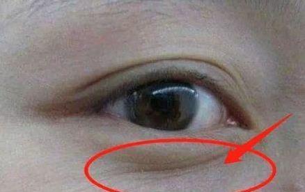 子宮健康的女性，臉上不會有4種表現，常喝1種水，子宮更光滑