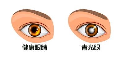 眼部寒冷損傷視神經小心青光眼，眼科醫師：一條毛巾護眼一把罩