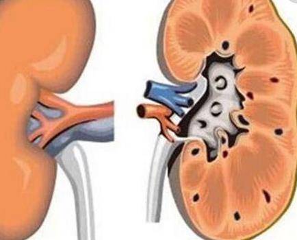 「腎」好不好看腳，如果腳上沒有3個表現，恭喜你，說明你的腎很健康