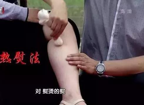 下肢這種疼痛，竟是糖尿病的預警信號！再不重視就晚了