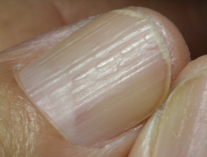 折手指≠關節炎！　12個其實「不用被網路嚇到」的正常生理狀況  