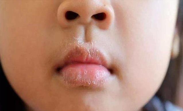 4種表現「暗示」你，寶寶脾胃出現了問題，4招調理脾胃簡單管用