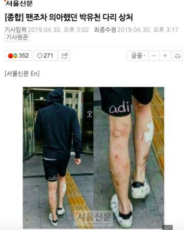 吸毒害皮膚潰爛？韓媒曝光朴有天，腳、手全都爛掉