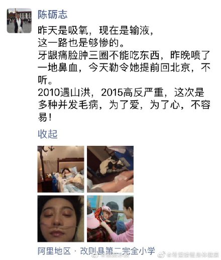 好嚇人！? 到西藏做慈善，范冰冰高原反應『臉腫3圈+鼻血噴滿地』！（內附多圖）