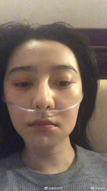 好嚇人！? 到西藏做慈善，范冰冰高原反應『臉腫3圈+鼻血噴滿地』！（內附多圖）