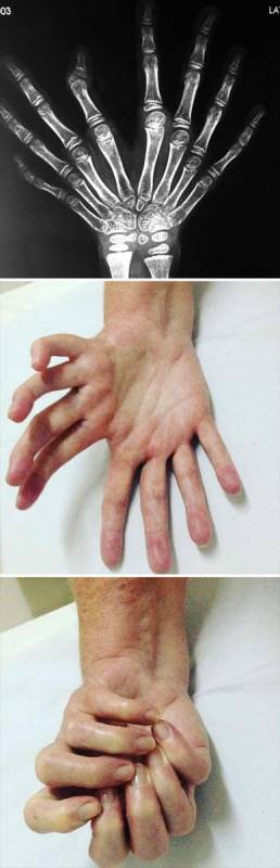 20個「不同於凡人」的稀有基因！一起來看看這些大自然在人體上創下的奧妙吧。