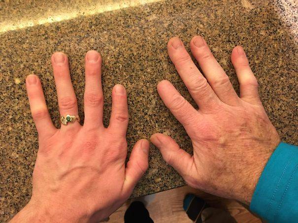 20個「不同於凡人」的稀有基因！一起來看看這些大自然在人體上創下的奧妙吧。