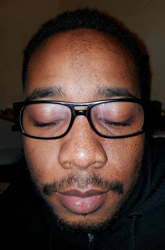 20個「不同於凡人」的稀有基因！一起來看看這些大自然在人體上創下的奧妙吧。
