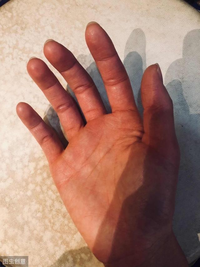 早起後，雙手出現2種現象時，是血脂升高了，一個小動作預防血栓