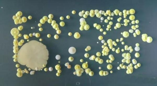 孩子不愛刷牙？把髒牙齒放大1000倍的圖片給他們看，我就不信他不刷牙！