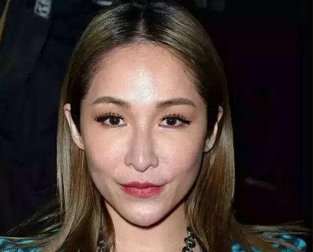 她曾是樂壇一代天后，感情史豐富換男友如換衣服，如今滿臉玻尿酸