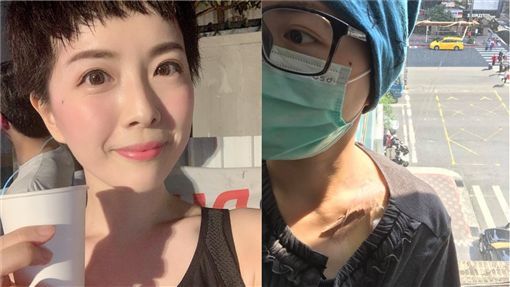 肚痛竟罹卵巢癌！部落客含淚切子宮竟被小三嗆爆：我比妳健康