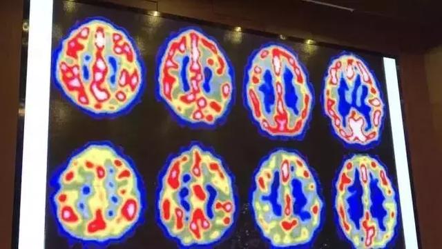 美國加州大學用醫學角度告訴你：想孩子學的好，掌握三種方法！