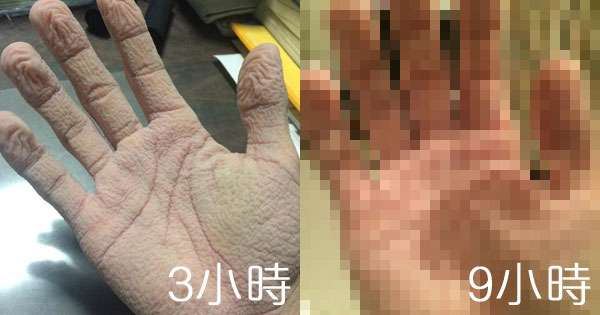 手泡在水裡變皺的極限在哪裡？日本網友超勇敢的實驗精神就算賣了雙手也要告訴大家這個答案。