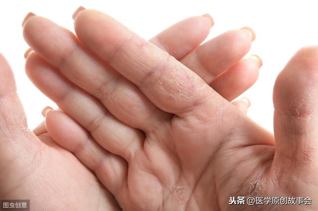 體內有癌，手指先知，手指若有這一個特徵，癌症可能已經到訪