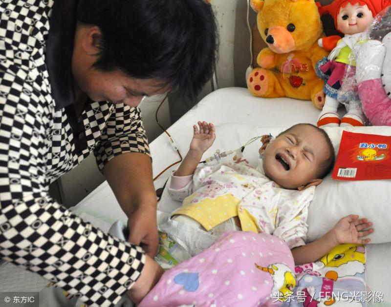 史上最小「孕婦」，因孩子是因寄生胎肚子才變大的，親生父母系全責！
