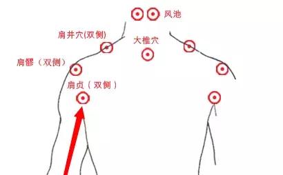 頸椎病，請認準這條經絡！