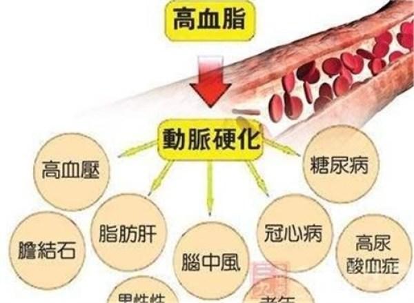 它們是導致高血脂的四大『殺手』, 5招可自我檢測
