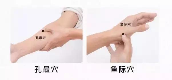 既然叫「濕疹」，說明體內濕氣重，廢水多，如何將水代謝很重要！